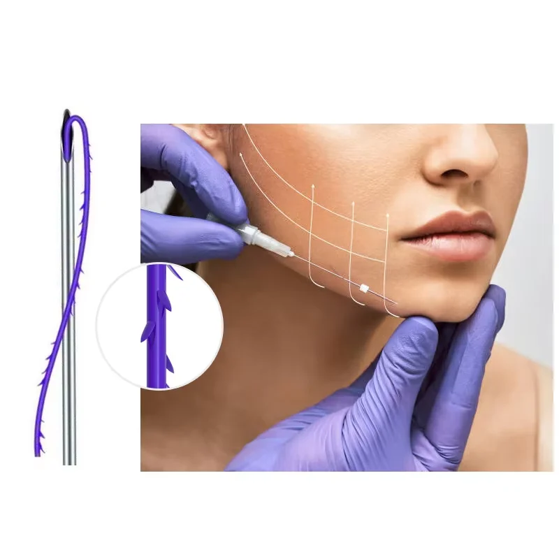 معقمة 5 قطعة/الحقيبة PDO Cog 4D الموضوع المتاح PDO Cog 4D الجر مسنبل المواضيع العقيمة الوجه مزدوجة الذقن رفع خط