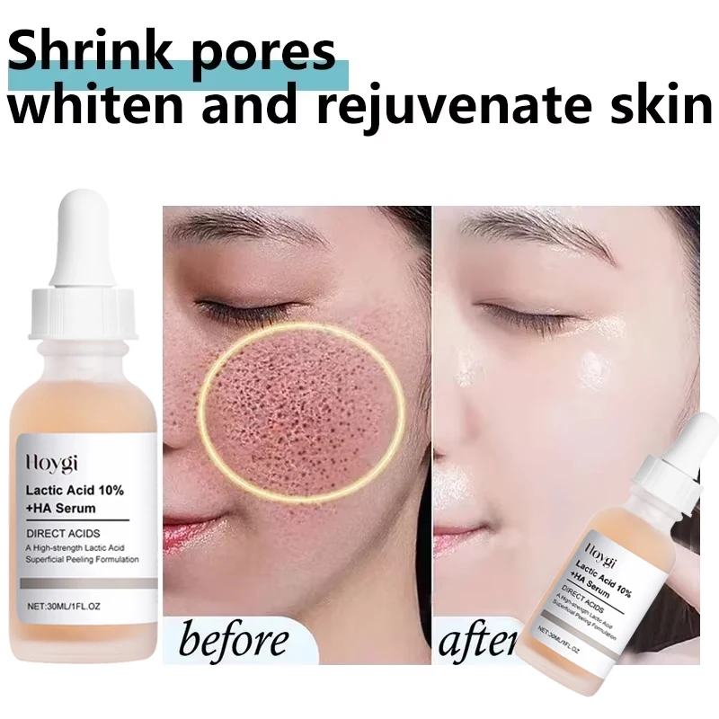 Lactic Acid Large Pores Removal Serum Fast Pore Shrinking Minimizing Essence Moisturizing Firming Smooth Repair Korean Skin Care 2