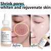 Lactic Acid Large Pores Removal Serum Fast Pore Shrinking Minimizing Essence Moisturizing Firming Smooth Repair Korean Skin Care 2