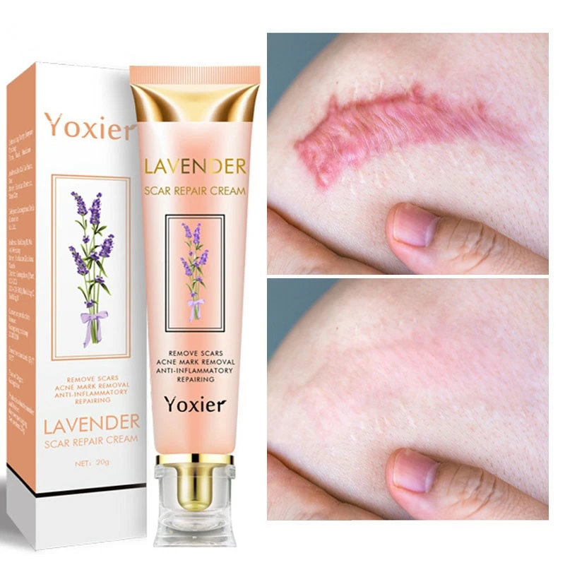 1pcs Scar Repair Cream Removal Burn Scars Promote Cell Regeneration Acne Treatment Remove Stretch Mark Smooth Skin Care |