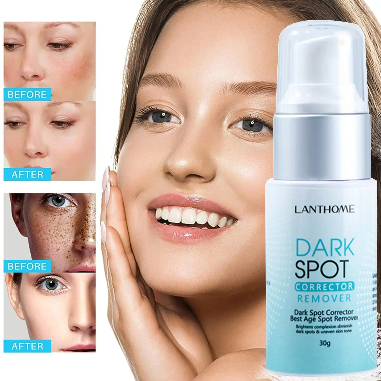 Lanthome Dark Spot Cream Remover Corrector, Whitening From Barrier