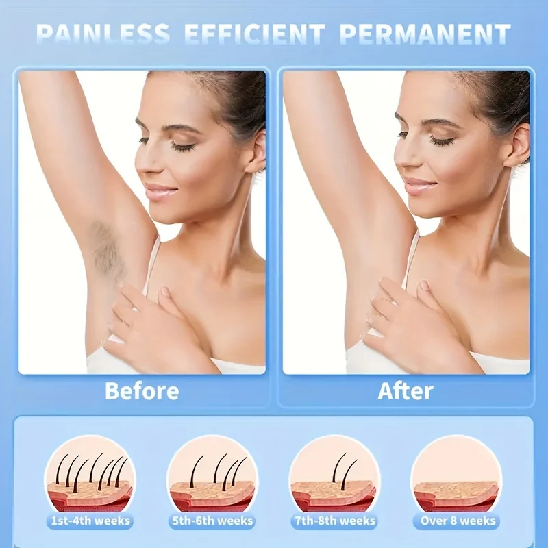 Hair Remover Ladies Epilator Razor USB Electric Hair Removal Instrument USB Portable Bikini Trimmer for Women