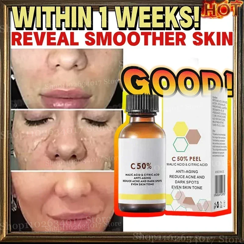Reduce Acne and Dark Spots Anti-aging Essence Chemical Exfoliants Moisturizer Face Oils Salicylic Acid Face Peel Neutraliser facial serum,facial essence,collagen face serum,salicylic acid facial serum