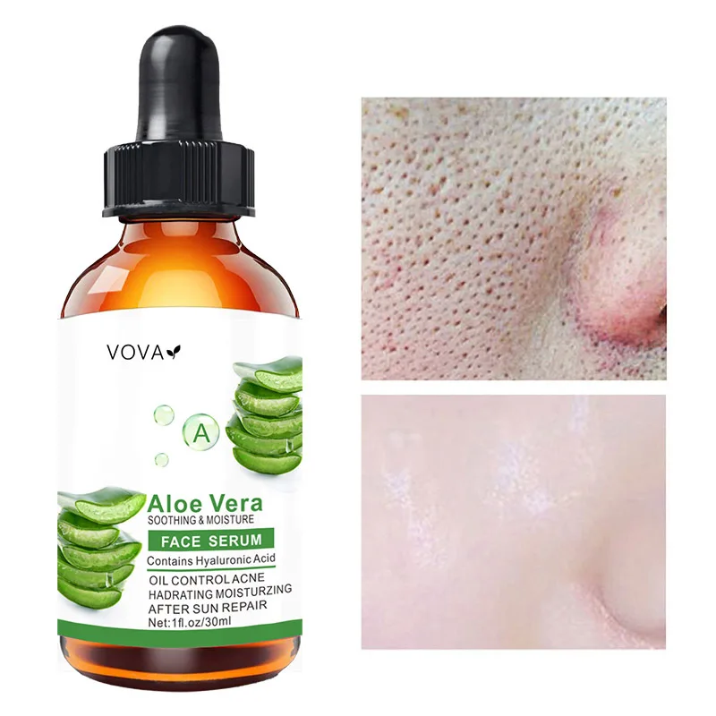 

Aloe Vera Face Serum Facial Soothing Moisturzing Essence Acne Treatment Anti-Aging Anti Wrinkle Essential Oil Skin Care