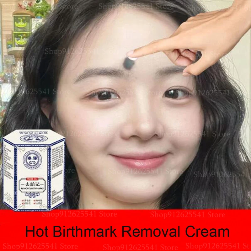 Birthmark Removal Cream Whitening Freckles Facial Spots Skin Dark Spot Remover Melanin Anti-Pigmentation Improve Dullness