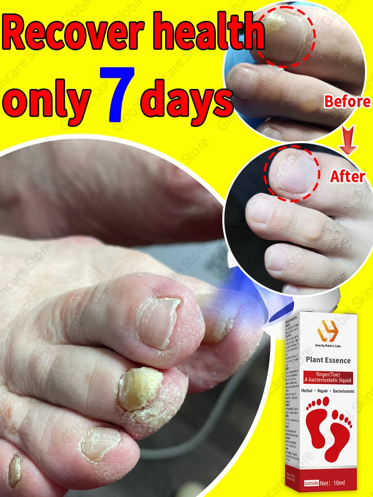 Portable nail cleaning equipment, professional nail laser irradiation, accessories