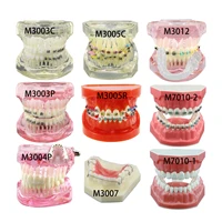 Dental Orthodontic Typodont Teeth Model With Self-Ligating Metal Ceramic Bracket Lingual Hawley Retainer Ligature Standard Demo 1