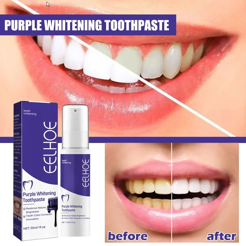 Sdottor-New-Purple-Dental-Beauty-Toothpaste-Teeth-Stain-Removal-Anti ...