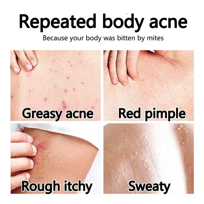 Vaseline Niacinamide Body Lotion Relieves Dry and Dehydrated Skin Exfoliates and Brightens Skin Tone Hydrating 400ml