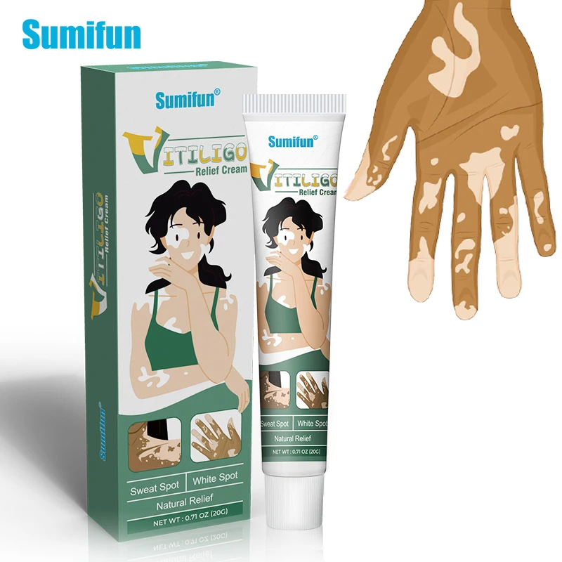 Sumifun Herbal Vitiligo Removal Ointment Leukoplakia Disease Treatment Cream 1Box