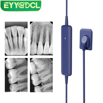 EYY Sensore dentale Unità radiografica ad alta frequenza HD Sistema di scanner per immagini Apparecchiatura per sensori intraorali digitali per riprese di raggi X dentali