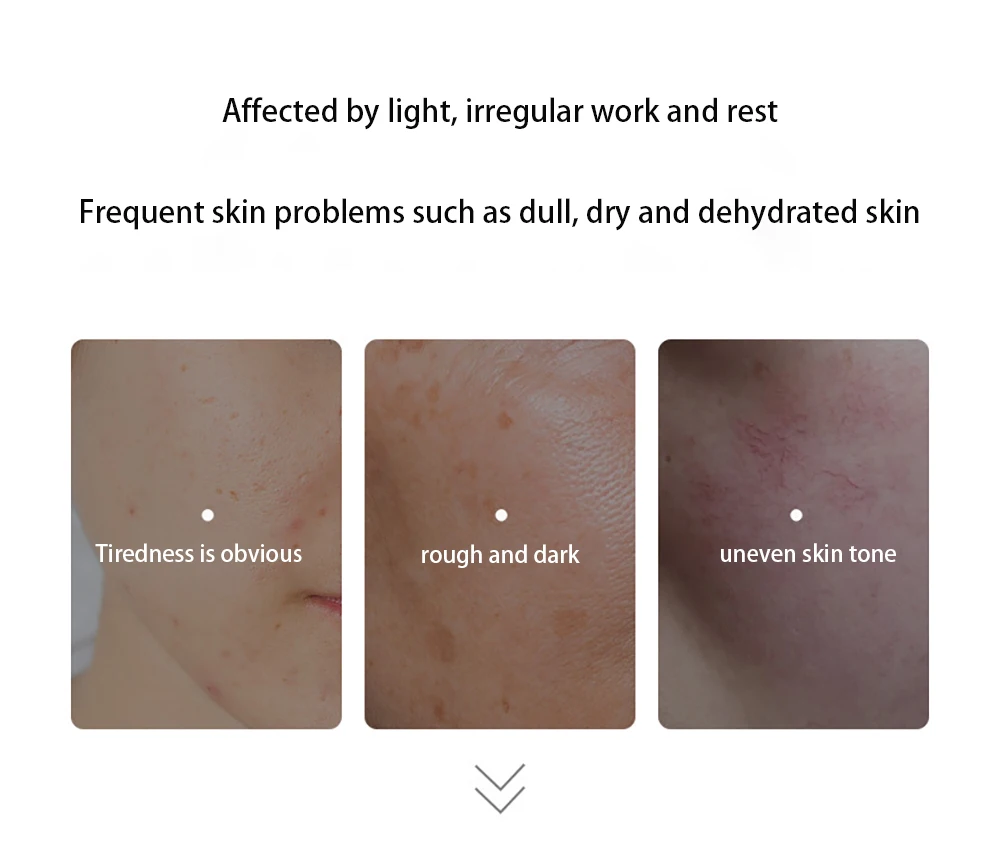 Specialized in repairing Soothing sensitive skin barriers face Lotion Moisturizing face Toner Fade red blood Essence skin care
