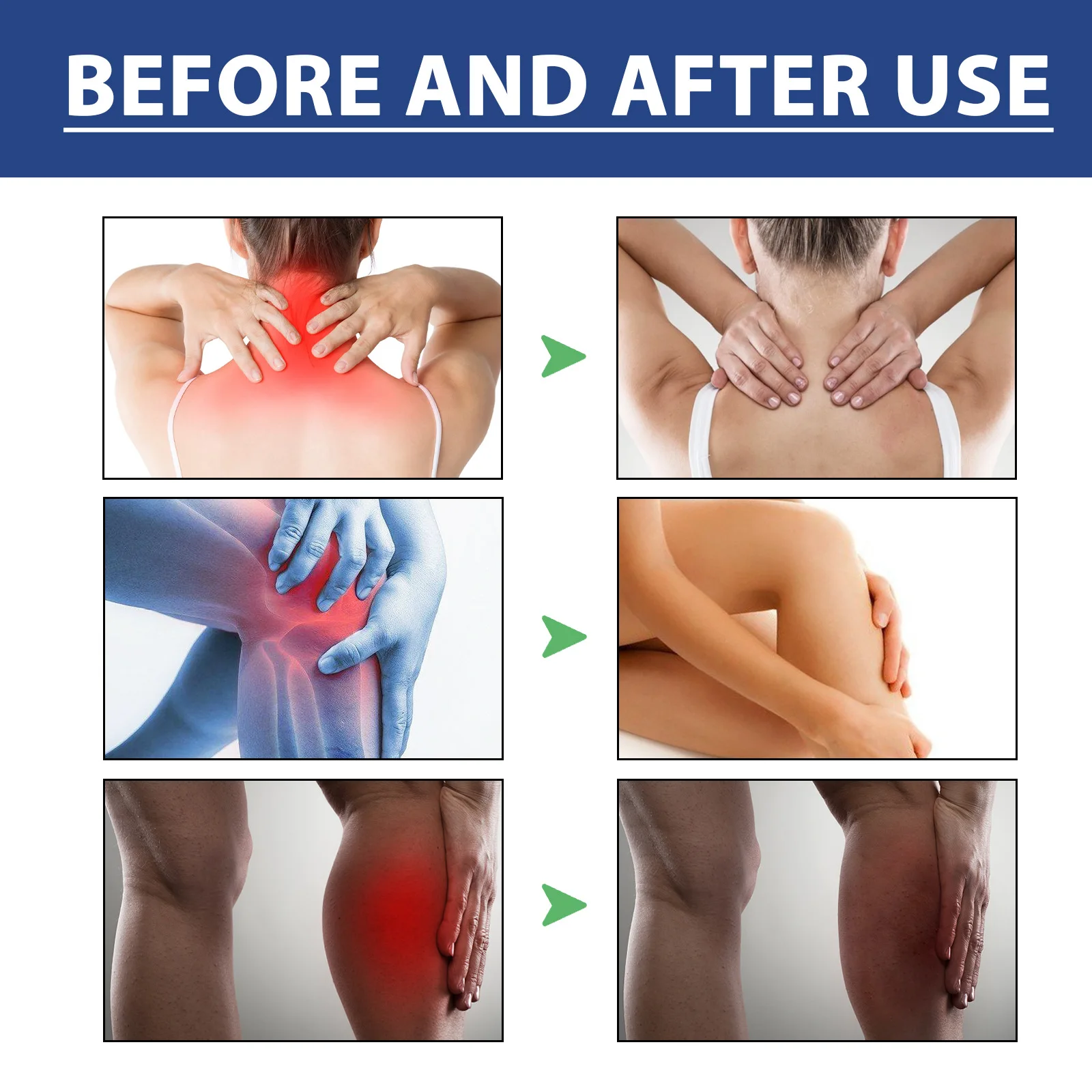 Knees Anti Pain Ointment Neuralgia Acid Stasis Relax Muscles Soreness Treatment Periostitis Rheumatism Arthritis Analgesia Cream