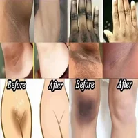 Crème blanchissante pour peau foncée, blanchiment des aisselles, éclaircissement et zone intime, hydratant pour femme, produits de soins coréens pour la peau 2