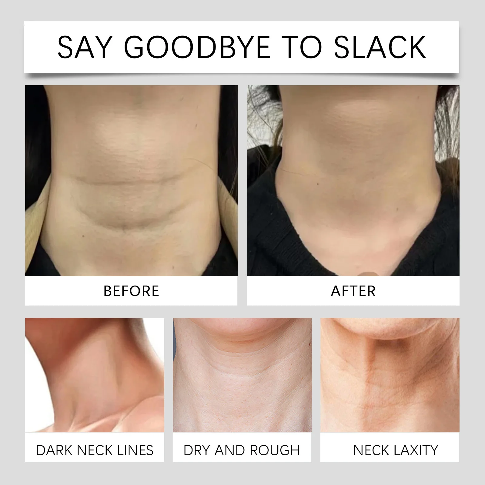 20개입 투명 목 리프팅 테이프 패치 포함 방수 탄력 목 주름 제거 접착 스티커 페이스 리프트 테이프