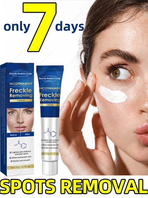 Remove Years of Spots Freckles Cream: A Dark Spot Remover for a Flawless Face