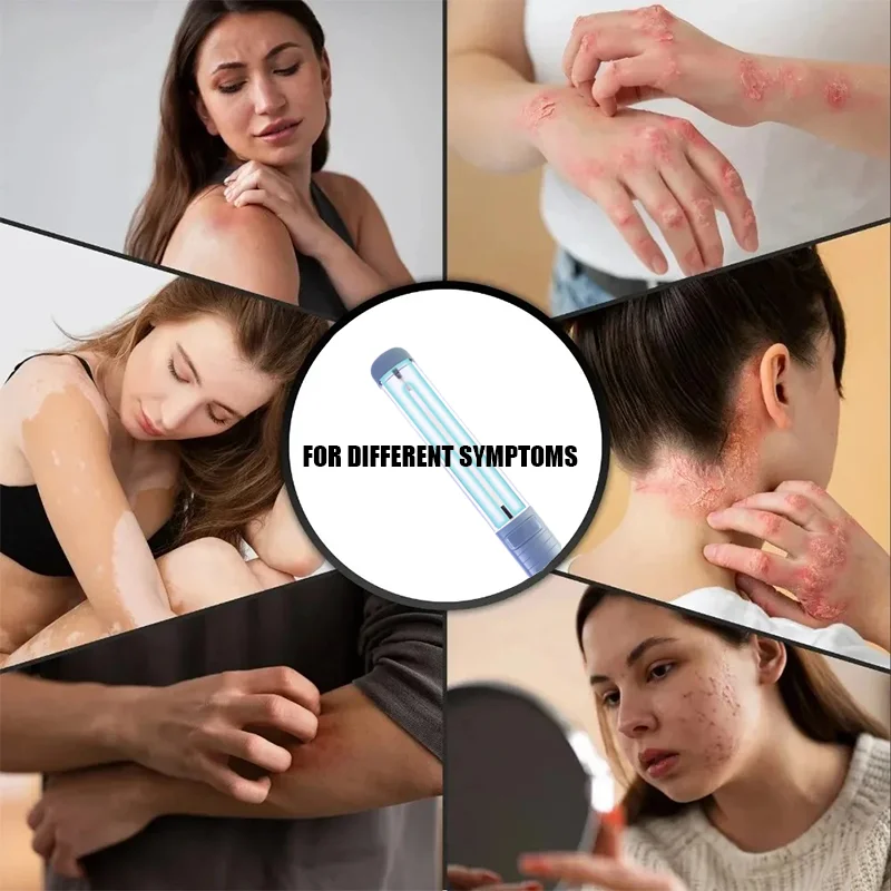 UVB 308NM  Phototherapy Lamp Device for Vitiligo Treatment UV NarrowBand Ultraviolet Light Therapy Psoriasis Spots Eczema 3