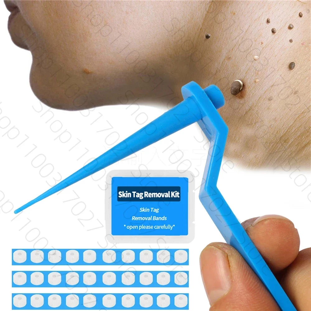 Removedor de verruga funciona? Descubra tudo sobre o tratamento caseiro  para verrugas, image size:1000x1000