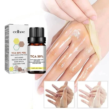 With Malic Acid And Citric Acid For Face Facial Peel 40% Peeling Serum Peeling Serum Chemical Peel
