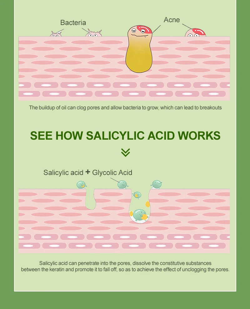 Description Picture 5 of itemSalicylic Acid Exfoliating Pads Oil Control Blackhead Removal Moisturizing Facial Masks Smoothing Lifting Firming Skin Care