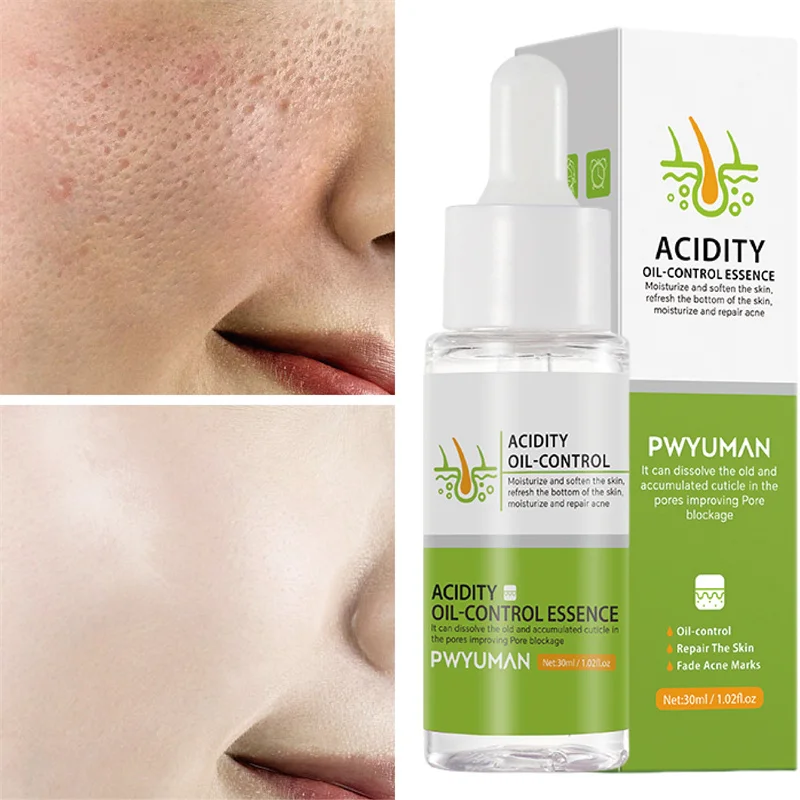 

Fruit Acid Shrink Pores Serum Remove Acne Repair Scars Remove Blackheads Soften Cuticle Moisturizing Oil Control Skin Care 30g