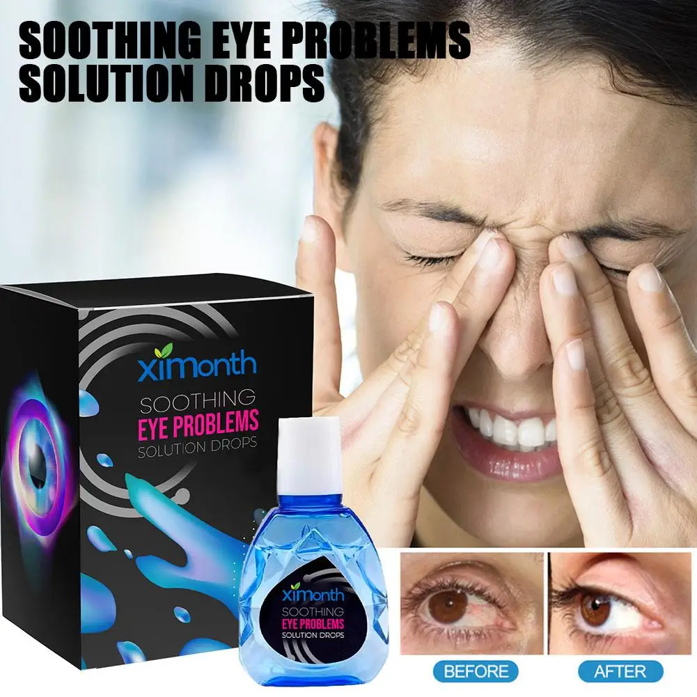 

10ml Treatment EyeProblems SolutionDrops Soothing Eye Circles Fatigue Problems Remove Eyesight Relieve Dark Eye New Improve X3A4