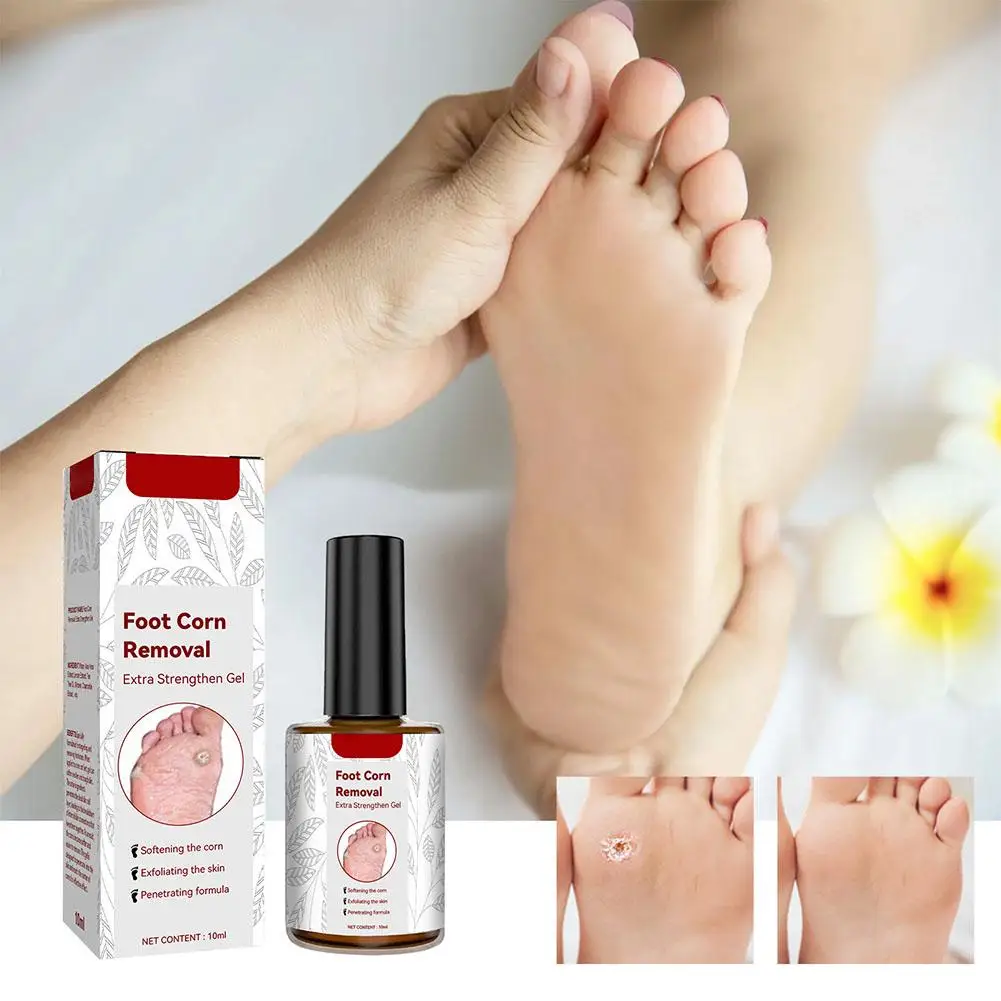 Foot Callus Removal Gel Moisturizing Softening Feet Cracked Improve Remove Skin Skin Heel Cream Anti Dead Roughness Dry