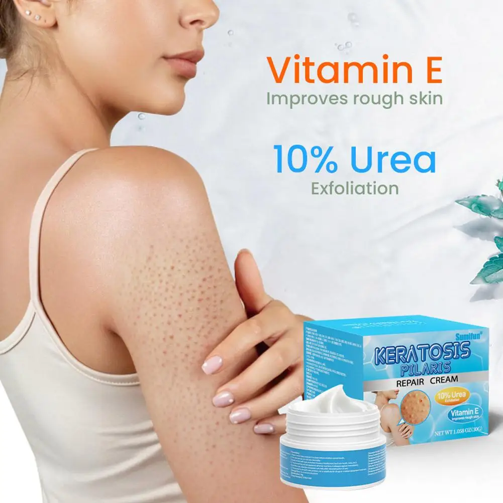 

Vitamin E Strawberry Legs Removal Body Scrub Chicken Skin Moisturizer Cream Skin Exfoliating Care Pimple Whitening 30g Urea Z1I6