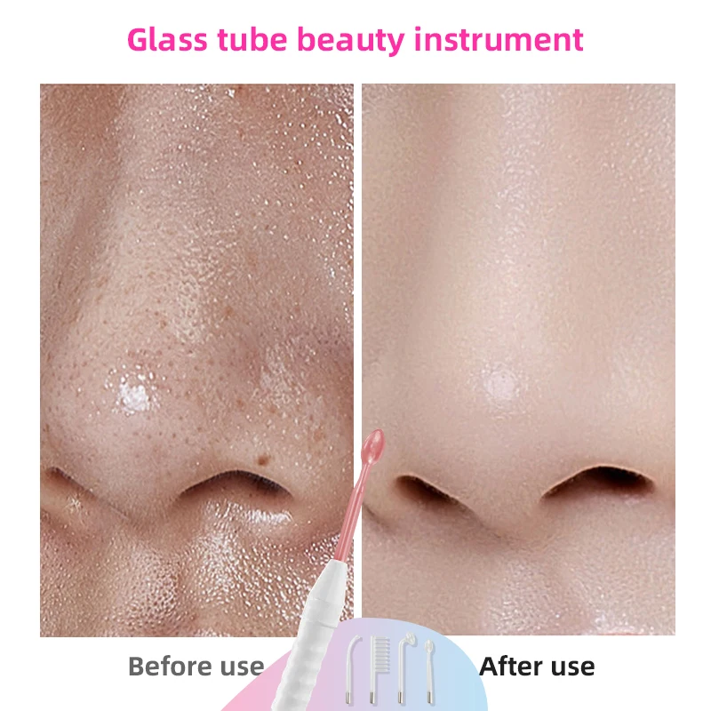 4in1 Electrode Glass Tube Machine Spot Acne Wand Facial Spa Face Skin Care Electrotherapy 4