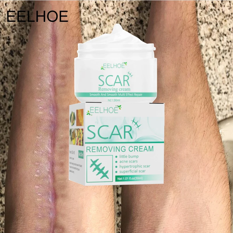 Eelhoe Scar Repair Cream Removes Acne Scar Scar Stretch Mark Removal