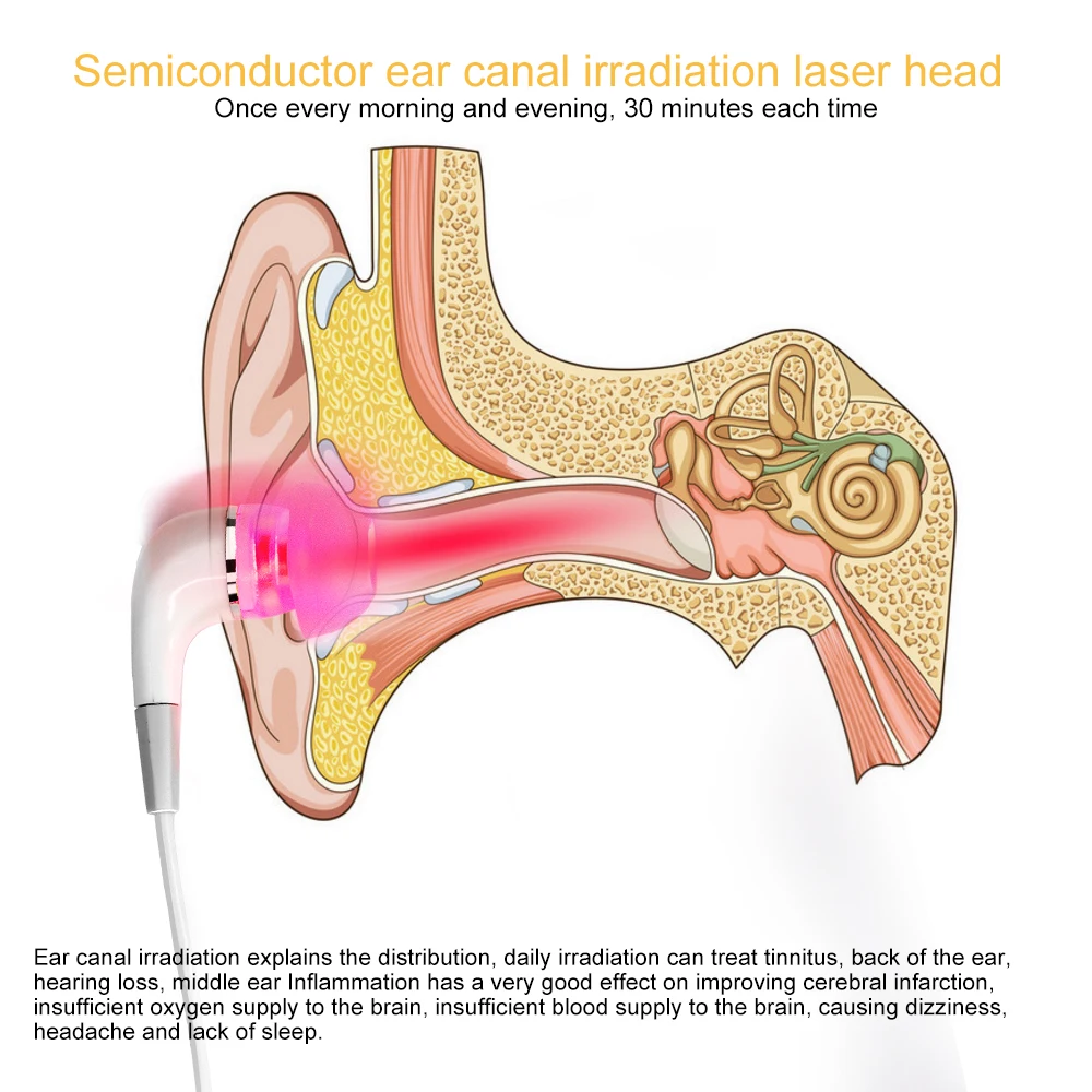 650nm Laser Physiotherapy Rhinitis Sinusitis Tinnitus Ear LLLT Irradiation Laser Therapy Earplug Otitis Media Deafness Treatment
