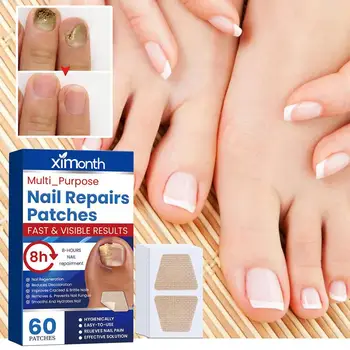 60pcs/Box Toenail Fungus Treatment Stickers Paronychia Removal Treatment Nail Ingrown Correction Stickers Pedicure Tools Care