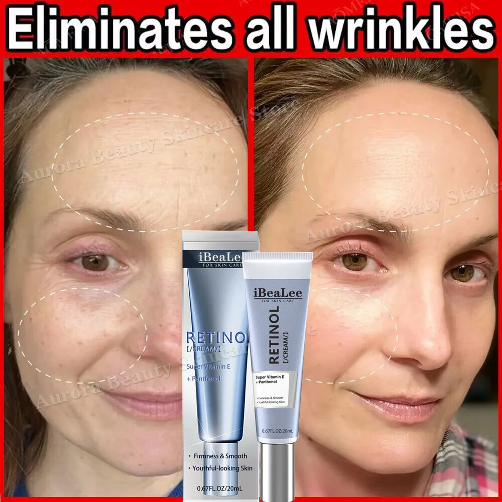 Retinol Øjeblikkelig rynkefjerner Ansigtscreme Fade Fine Linjer Anti-aldring Opstrammende Lifting Blegning Fugtgivende hudpleje_voghion.com