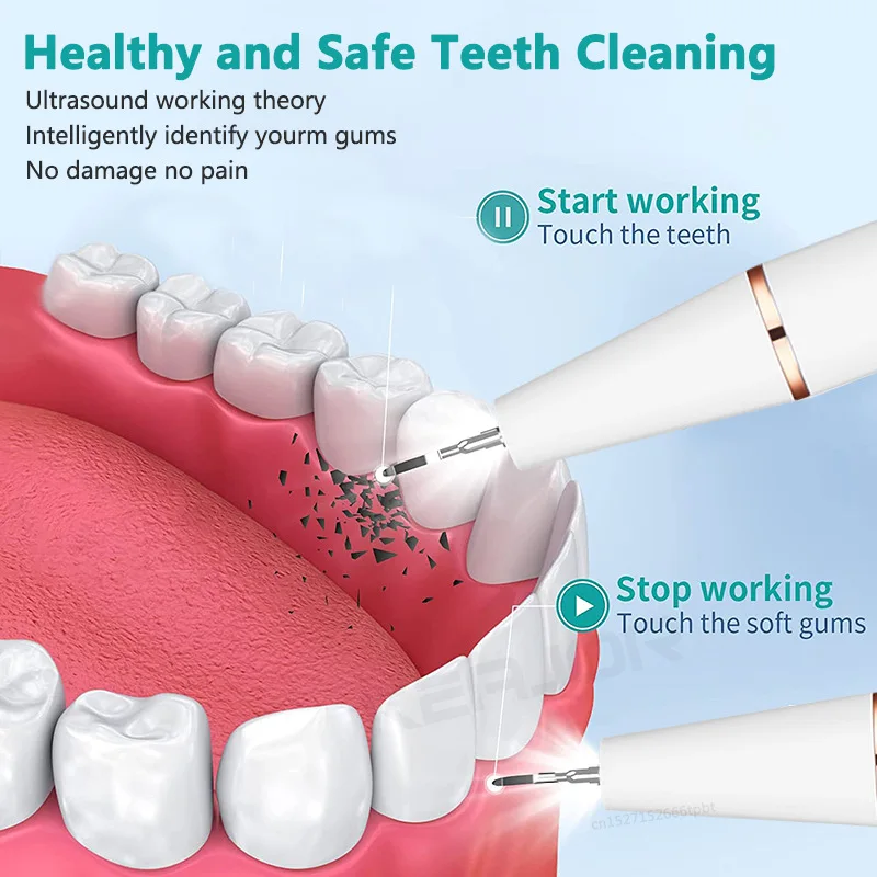 Ultrasonic Dental Scaler For Teeth Tartar Stain Tooth Calculus Remover Electric Sonic Teeth