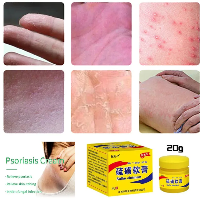 Sulfur Antibacterial Cream Soap Spray Set Psoriasis Eczema Antiitch