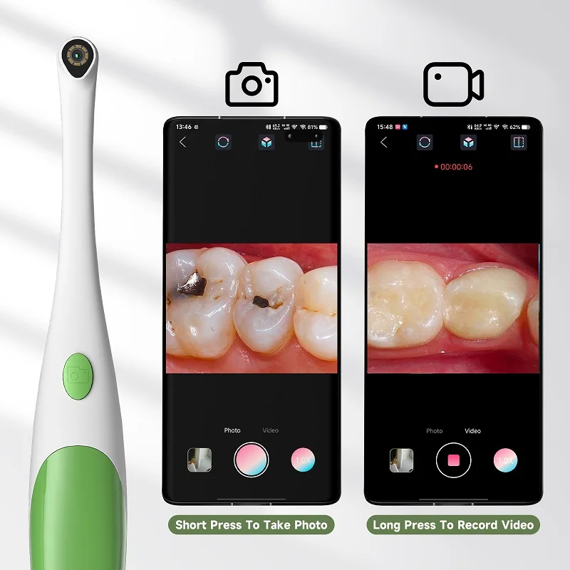 Cámara Intraoral USB Dental Endoscopio Borcope 6 Luz LED Cámara USB Para El Hogar - China Endoscopio, Cámara Oral