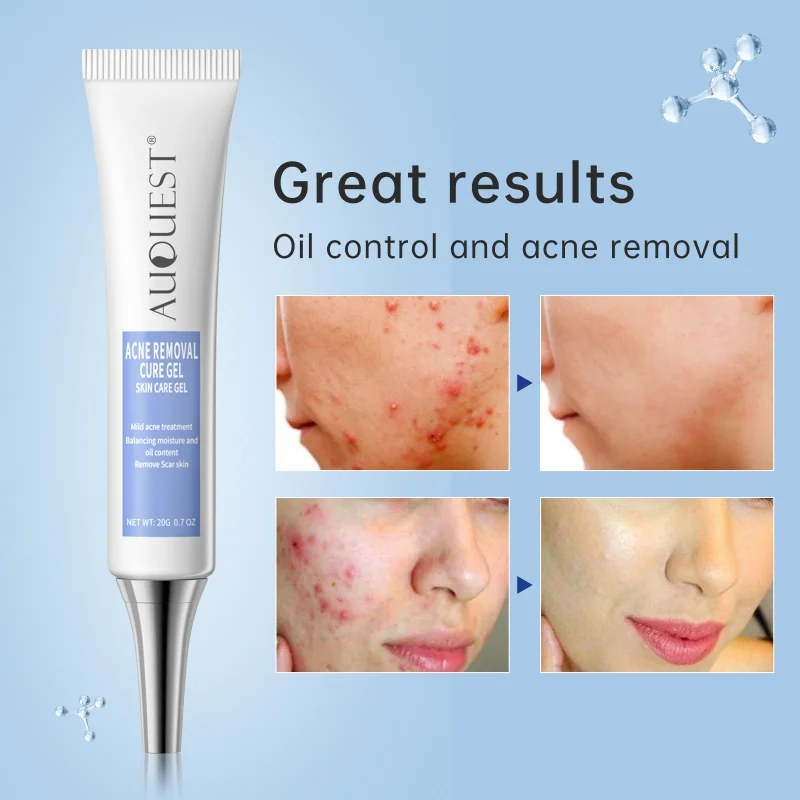 

Средство для лечения акне и шрамов, 20 г