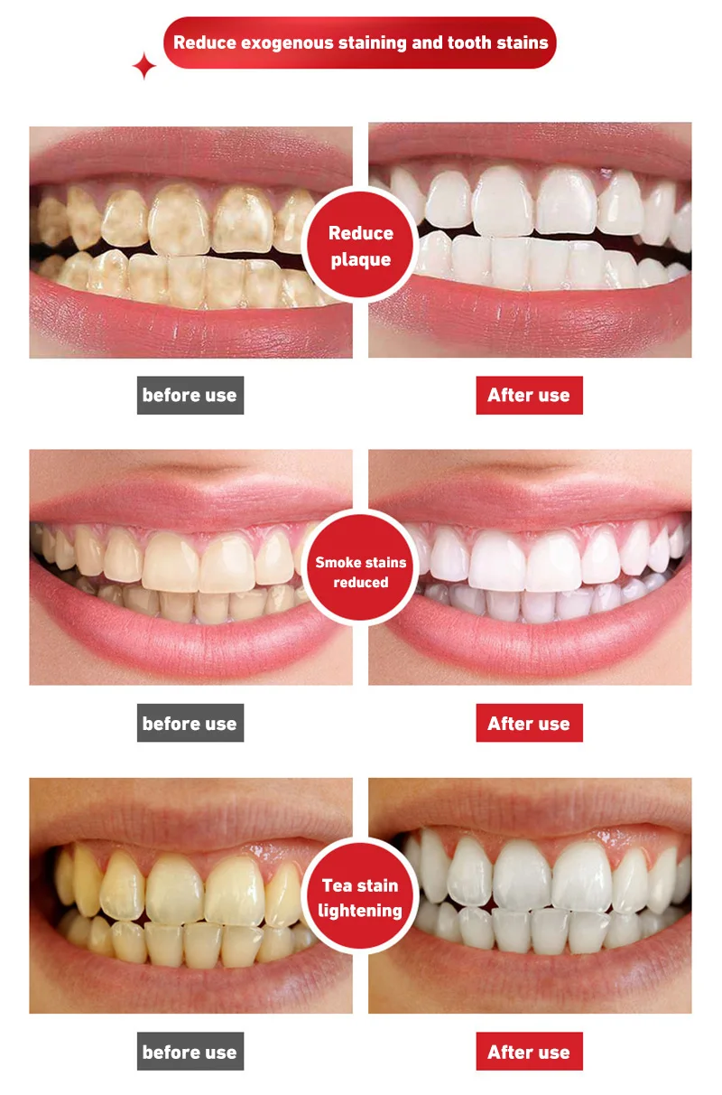 120g Probiotic Toothpaste Sp-4 Whitening Tooth Remove Plaque Stains Teeth Whitener Oral Hygiene Clean Fresh Breath Dental Tools