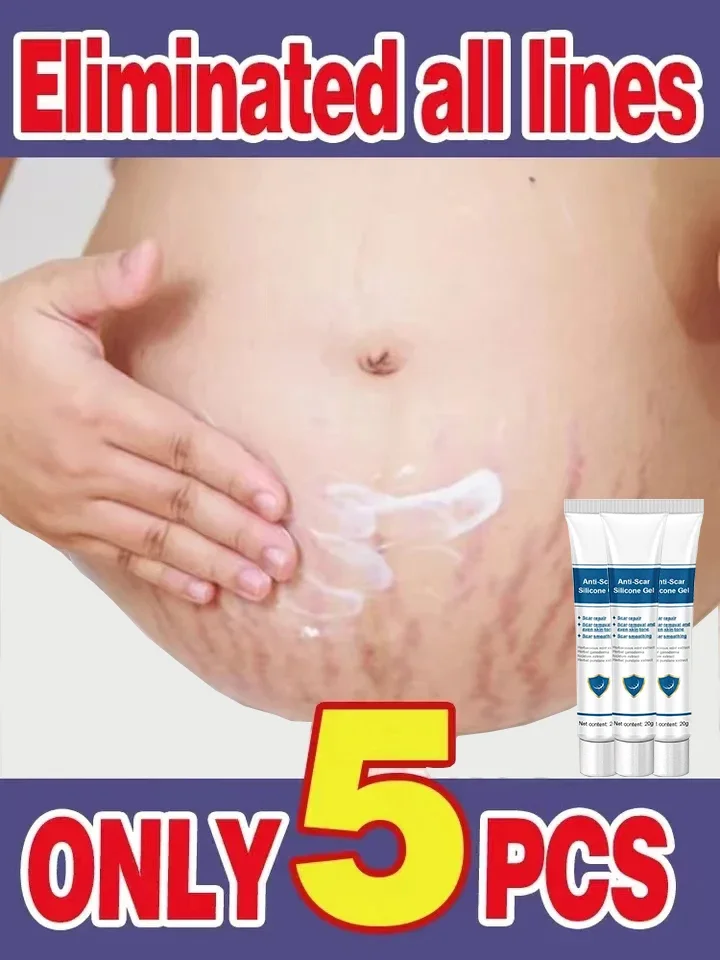 Stretch Marks Cream Eliminate Red White Old For Pregnancy Postpartum Skin Care Gel