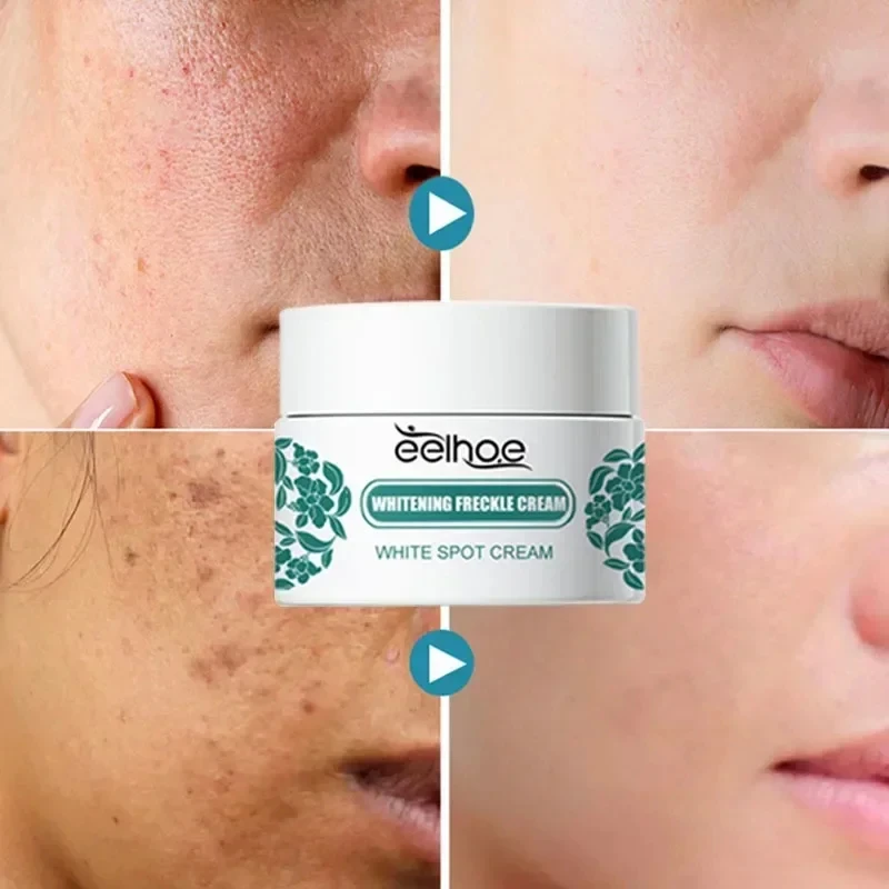 eelhoe Niacinamide Melasma Brightening Cream Reduce Melanin Brighten Cream Lighten Dark Skin Chloasma Serum Fade Fine Face Lines 2