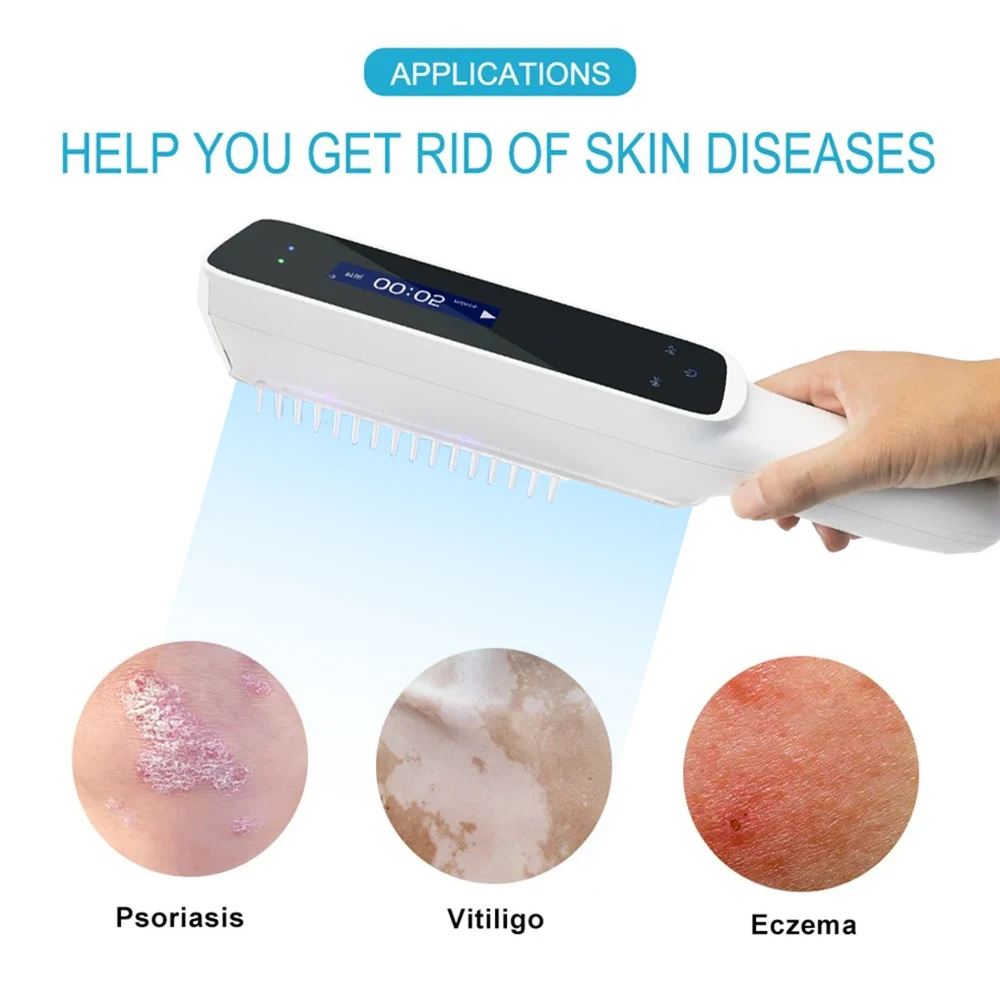 311NM psoriasis Ultraviolet Physiotherapy Instrument Psoriasis Therapy Device White Spot Treatment Light Home Physiotherapy 5