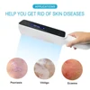 311NM psoriasis Ultraviolet Physiotherapy Instrument Psoriasis Therapy Device White Spot Treatment Light Home Physiotherapy 5