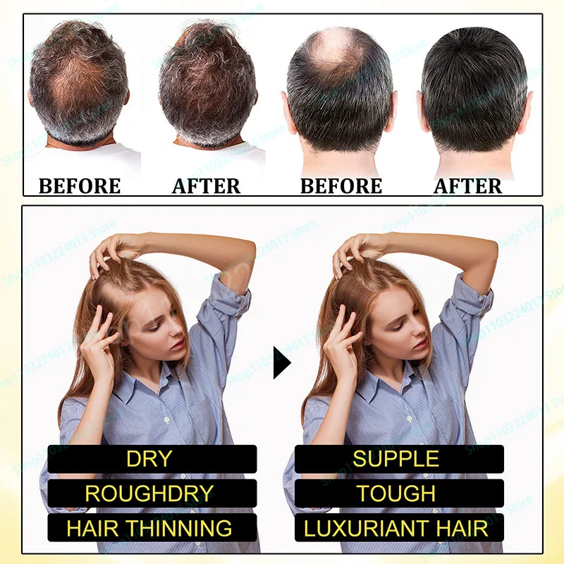 Description Picture 6 of item7 Days Fast Hair Growth Ginger Growth Hair Oil Treatment Anti Hair Loss Men Women Scalp Treatment Serum Products Beauty Health