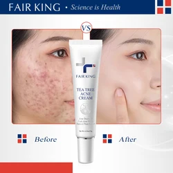 FAIRKING Tea Tree AcneCream Fade Pimples Skin CareScars Repair Removal Pore Shrinking Control Moisturizing Smoothing Skin Care