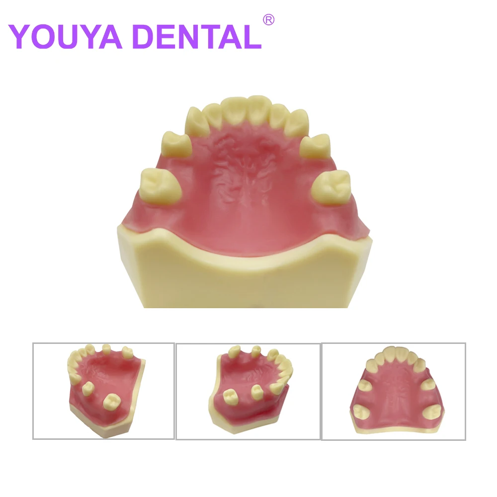 

Dental Teeth Model for Implant Dentist Student Studying Teaching Models Dentistry Practice Typodont Demonstration Tools Products