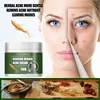 Crème anti-acné efficace, traitement, cicatrice d'acné, rétrécissement des Pores, contrôle du sébum, blanchiment, hydratation du visage, Ginseng, herbes, soins pour la peau