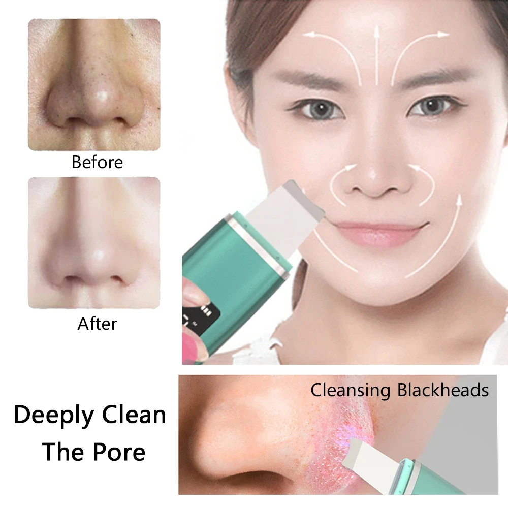 Ultrasonic Skin Scrubber Peeling Blackhead Remover Deep Face Cleaning Ultrasonic Ion Acne Pore Cleaner Facial Shovel Scrubber