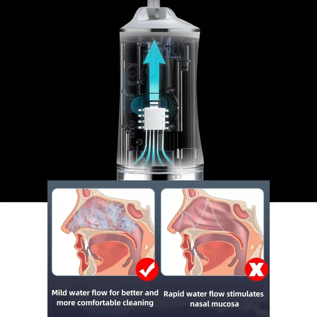 Nose Treatment Nose Wash Cleaner Pulse Electric Nasal Irrigator Adult Sinusitis Nasal Congestion Washer Children's Domestic Flushing Anti Choking