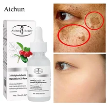 

Arbutin Whitening Freckle Face Serum Fade Dark Spots Acne Mark Moisturizing Essence Reduce Melasma Melanin Brightening Skin Care