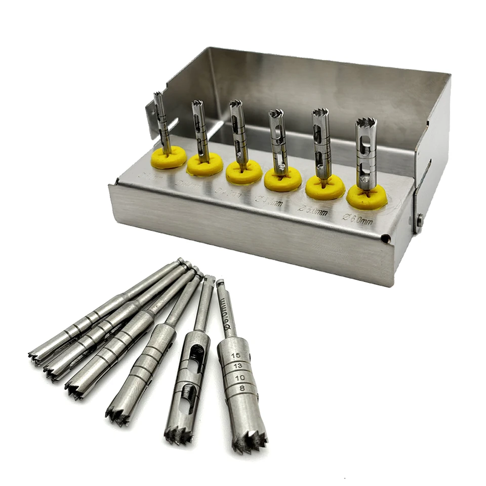 S094beef9df894772b9e3d6f1ab011